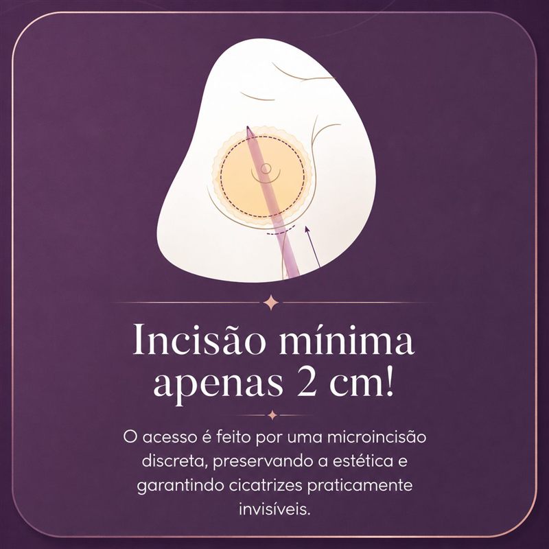 Incisão mínima, apenas 2 cm