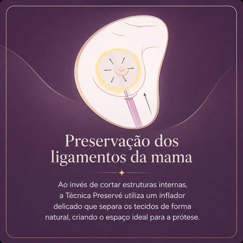 Preservação dos ligamentos da mama